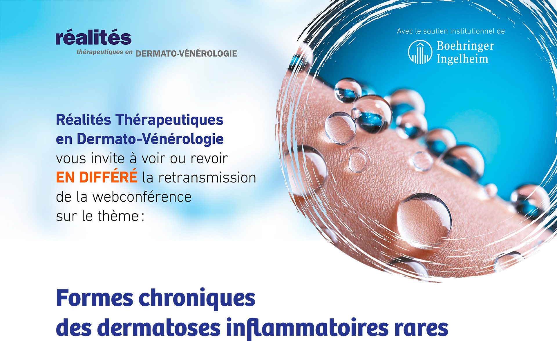 Accédez au différé